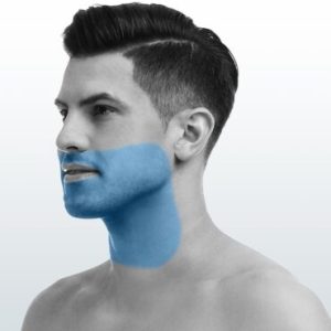 Depilación Barba