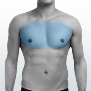 Depilación Pectoral